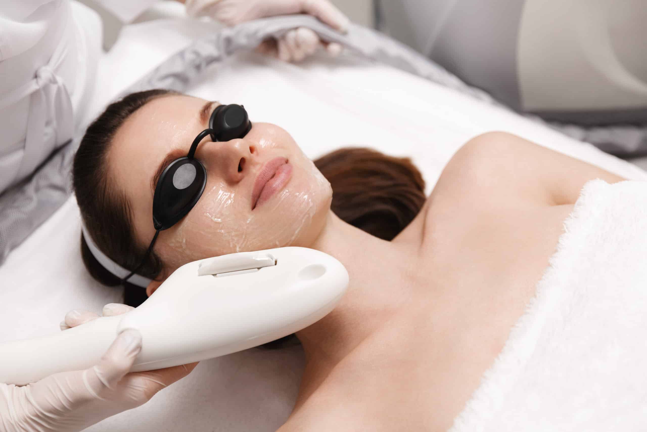 Get IPL Photofacial Therapy in Holly Springs, NC | SKYNN MD
