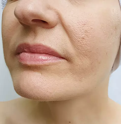 a close-up of a woman's face in Holly Springs, NC